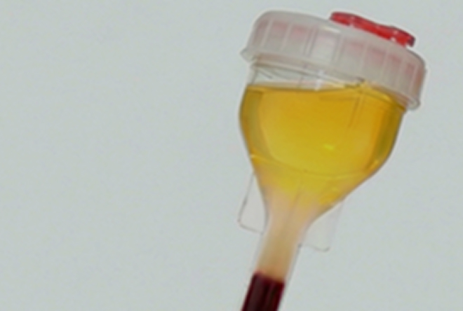 PRPスキンリジェネレーション