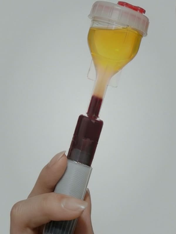 PRPスキンリジェネレーション