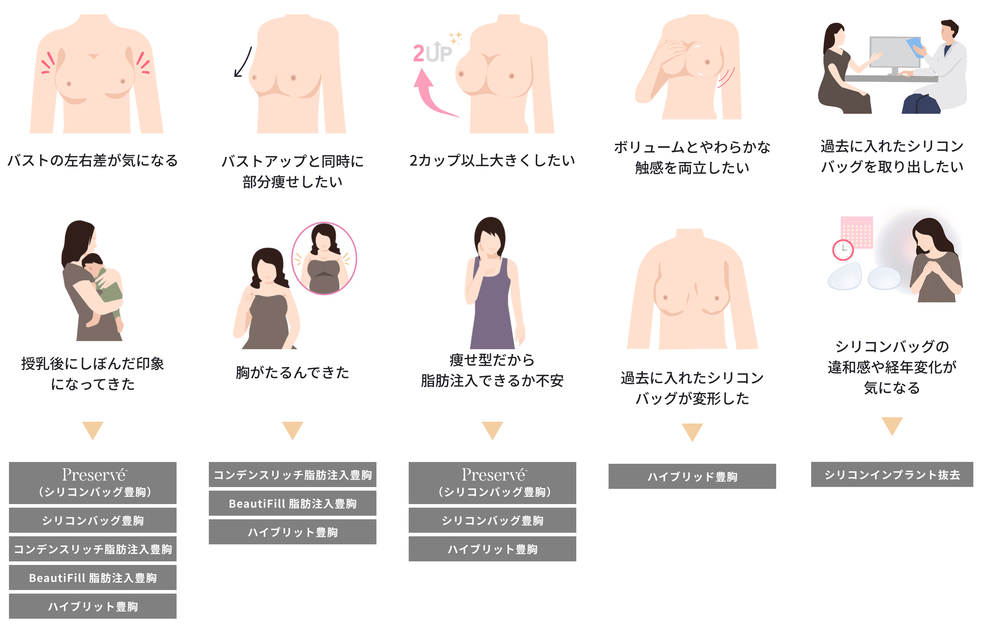 バストの左右差、授乳後のしぼみ、部分痩せ、シリコンバッグの変形、シリコンインプラント抜去などのお悩みとおすすめ施術