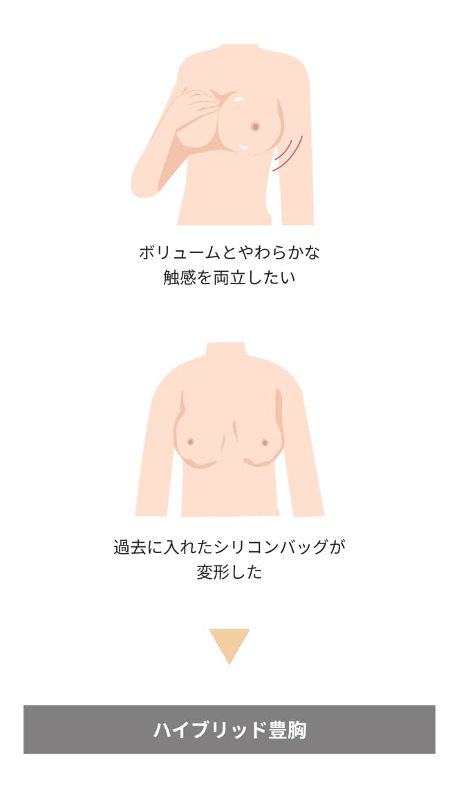 ボリュームとやわらかな触感を両立したい