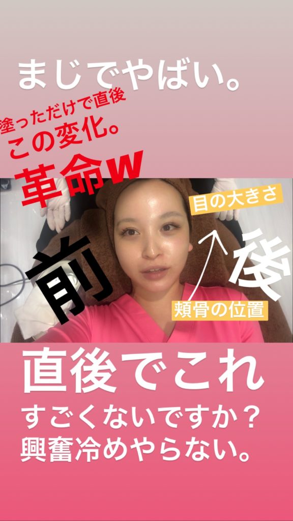 まさに革命✨❗️ マッサージピール