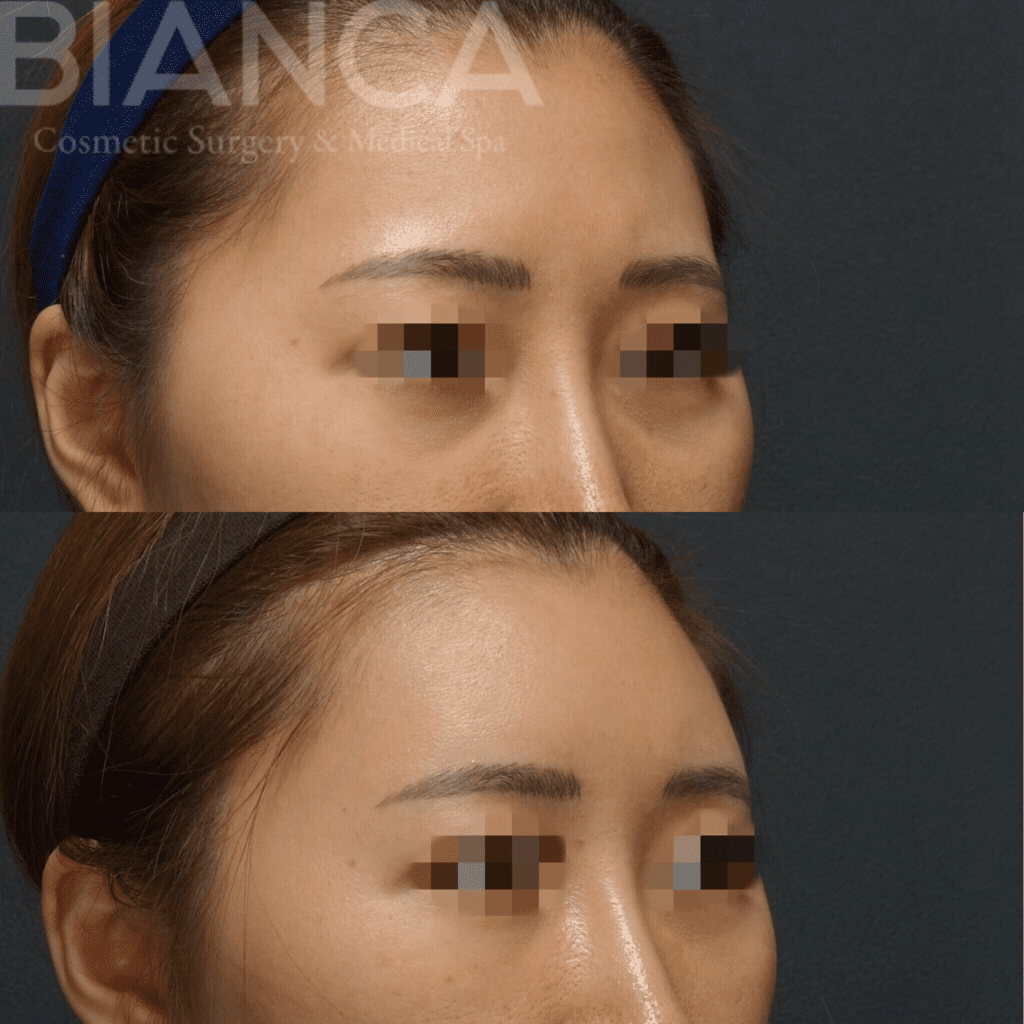 コンデンスリッチフェイス