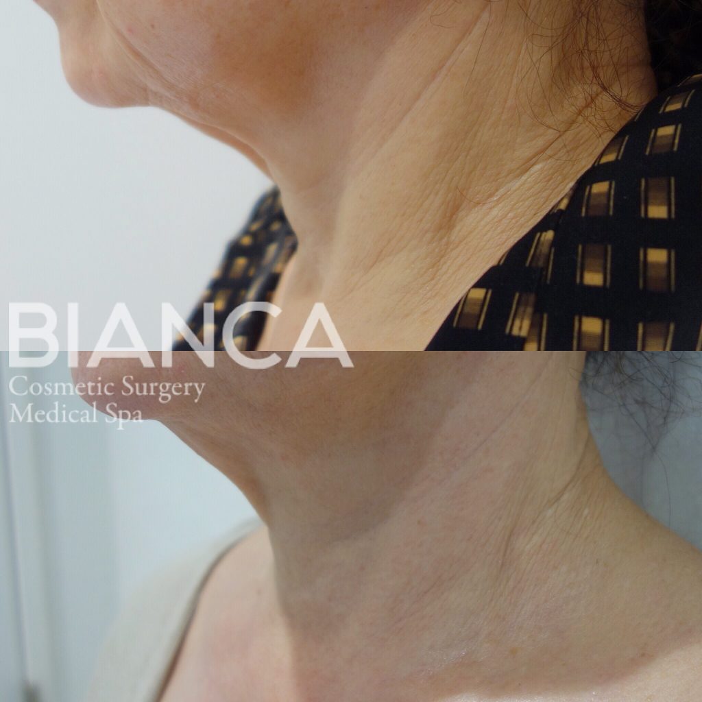 マッサージピール&ホームケア✨