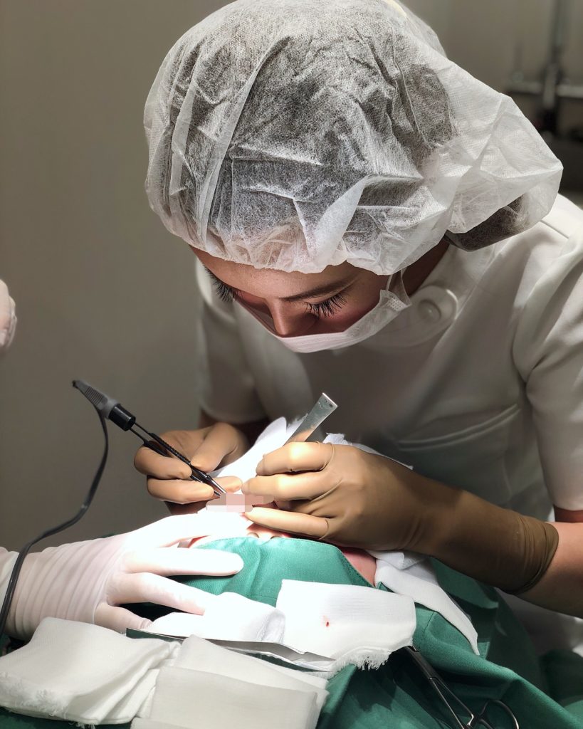 ヒアルロン酸 ボトックス 美容整形手術…⭐️モニター様募集中