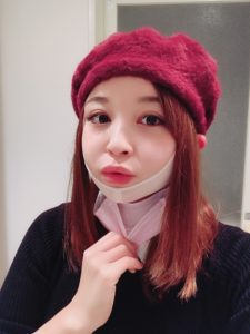 大久保由有医師の脂肪吸引ダウンタイム-フェイスバンドとマスクと帽子着用