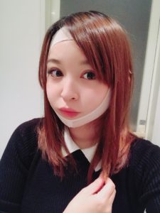 大久保由有医師の脂肪吸引ダウンタイム