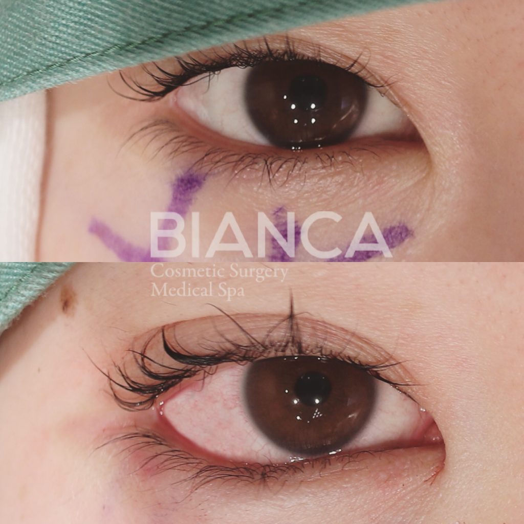 グラマラスライン形成✨タレ目で可愛い目元に👀💓