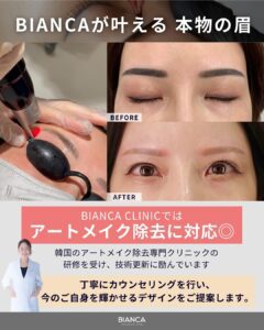 眉アートメイクで後悔している方にはアートメイク除去という方法も