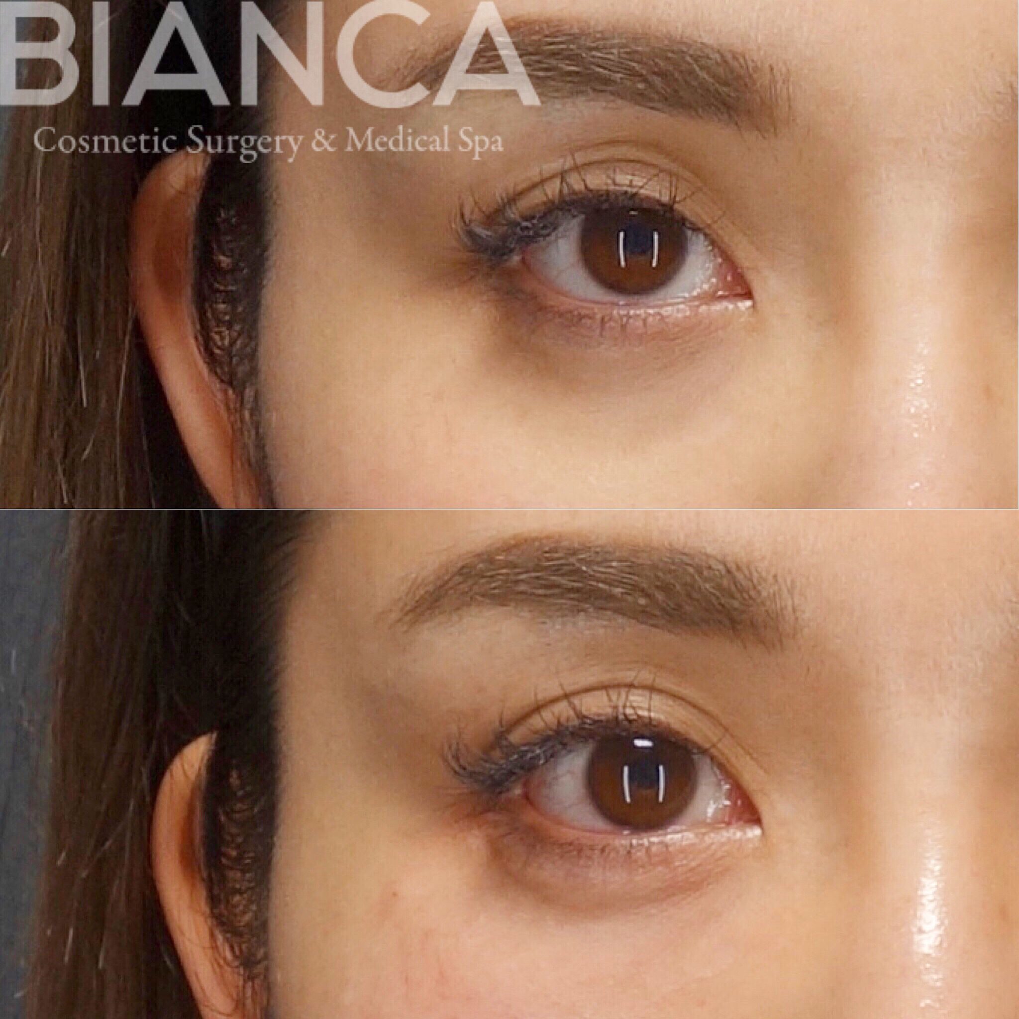 ヒアルロン酸＋ベビーコラーゲン