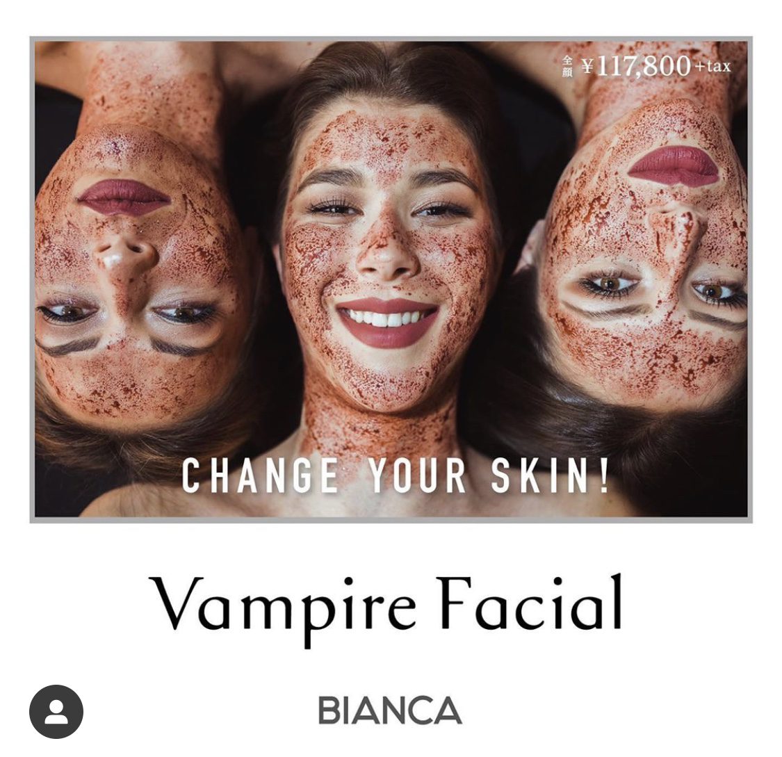 ヴァンパイアフェイシャル