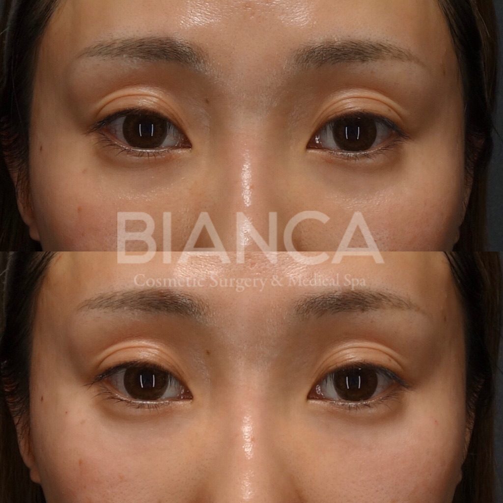 ベビーコラーゲン