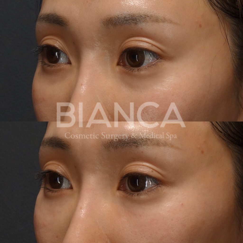 ベビーコラーゲン