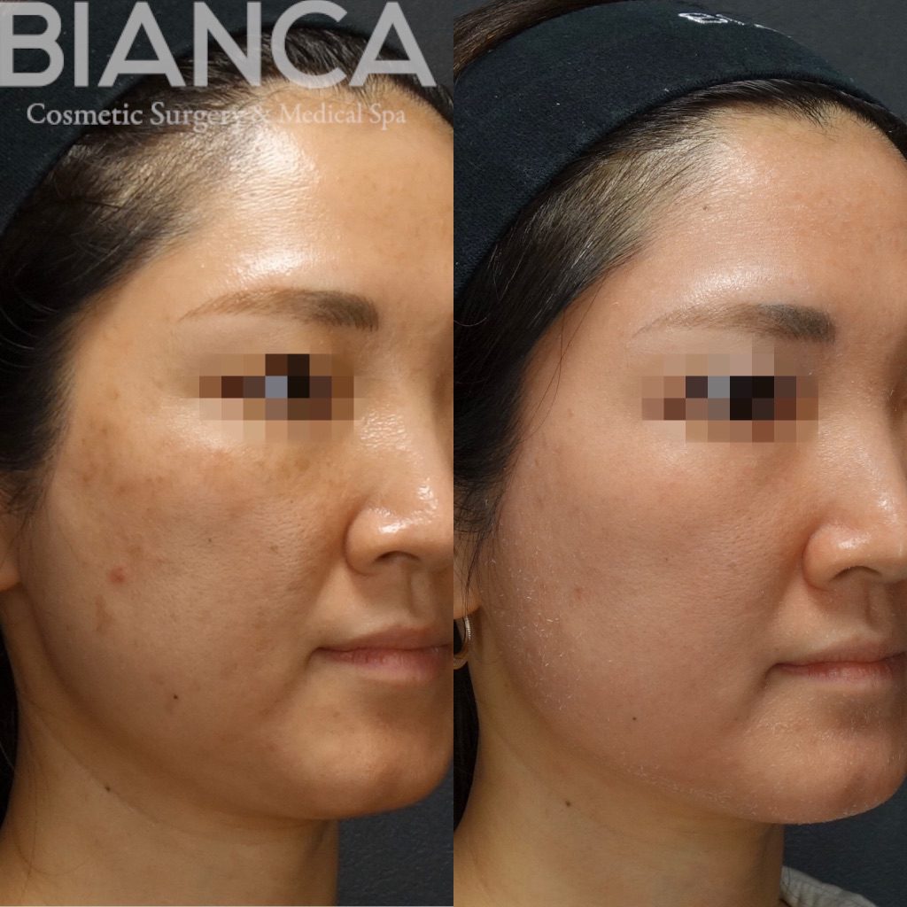 これぞZO SKIN ‼️