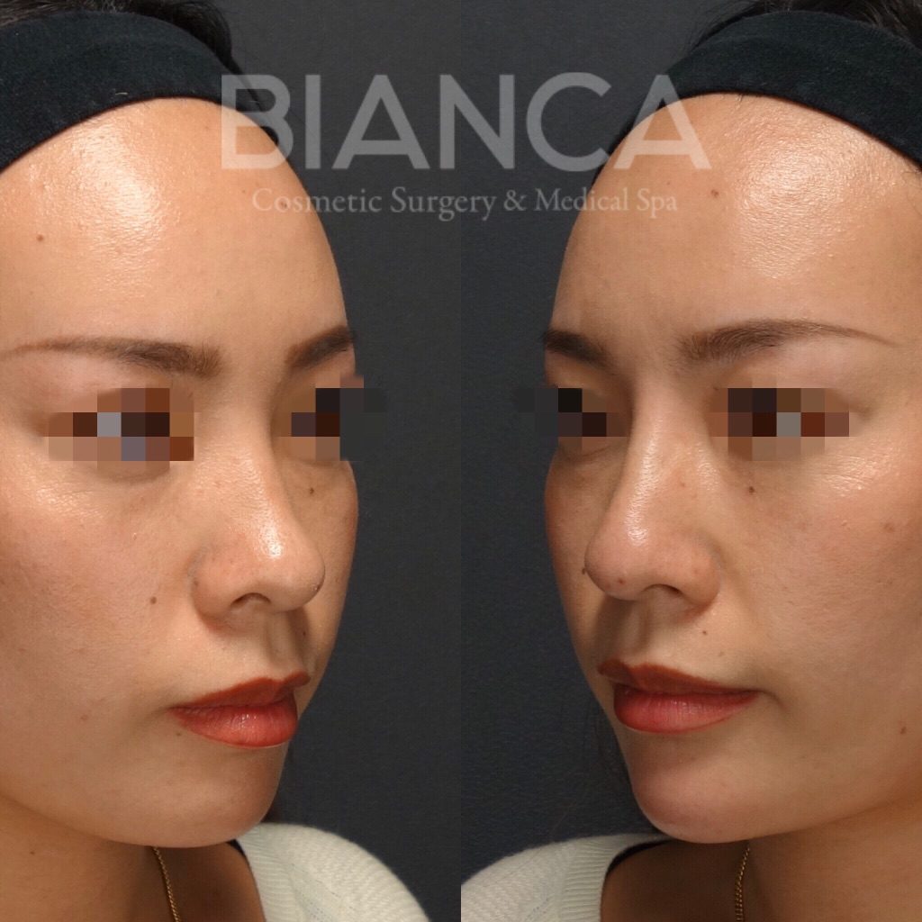 鼻と顎のバランス