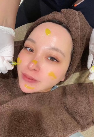 ピーリング新治療！！ピーリングパラダイス✨