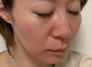 ゼオスキン～セラピューティック～3日目