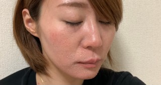 ゼオスキン～セラピューティック5日目～