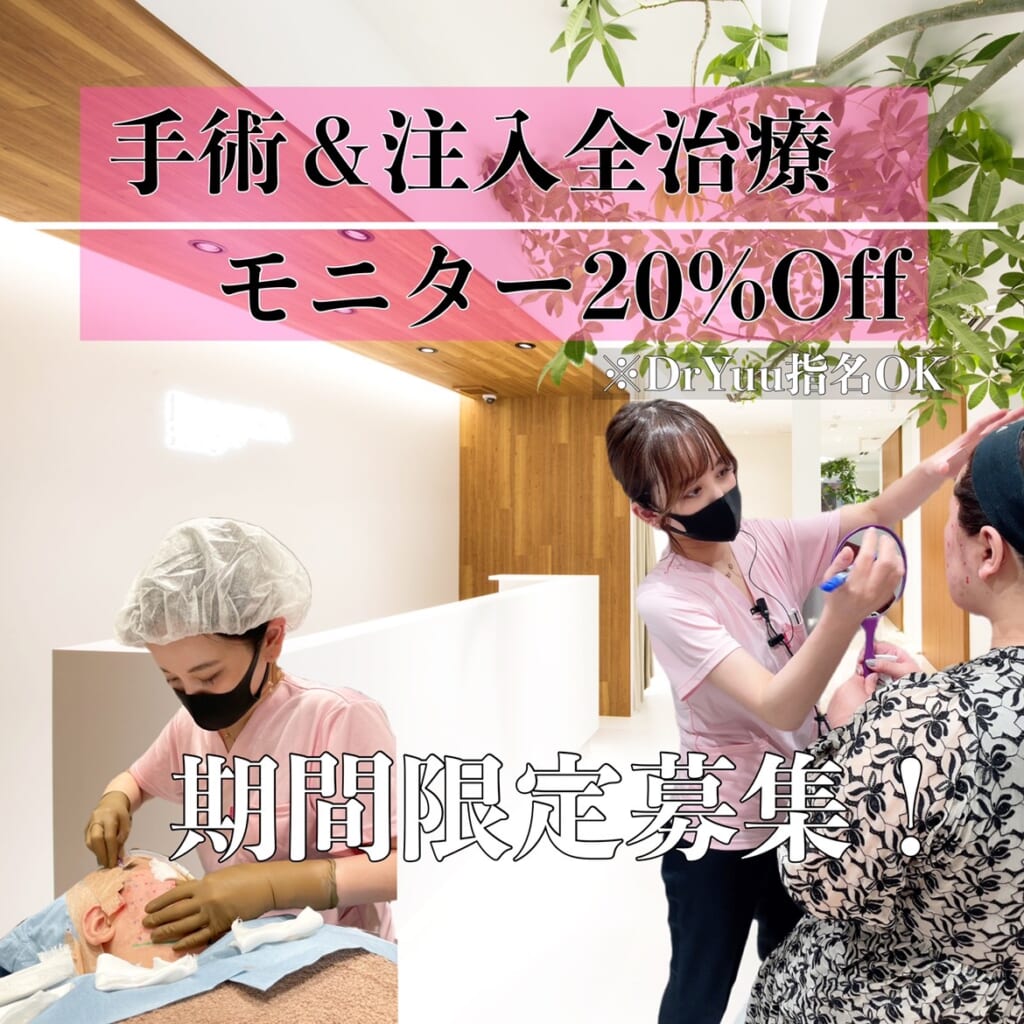 全メニューモニター募集中✨✨