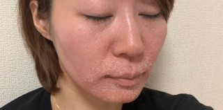 ZOSKIN(ゼオスキン)～セラピューティック7日目～