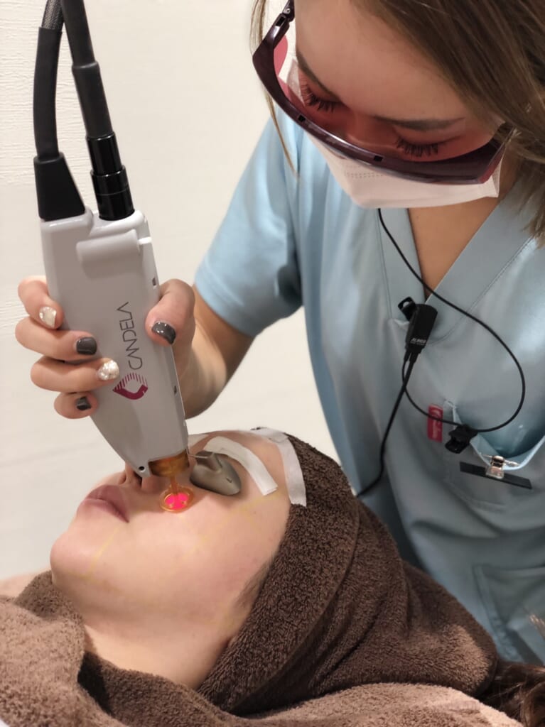 隠れメニュー🤫顔脱毛