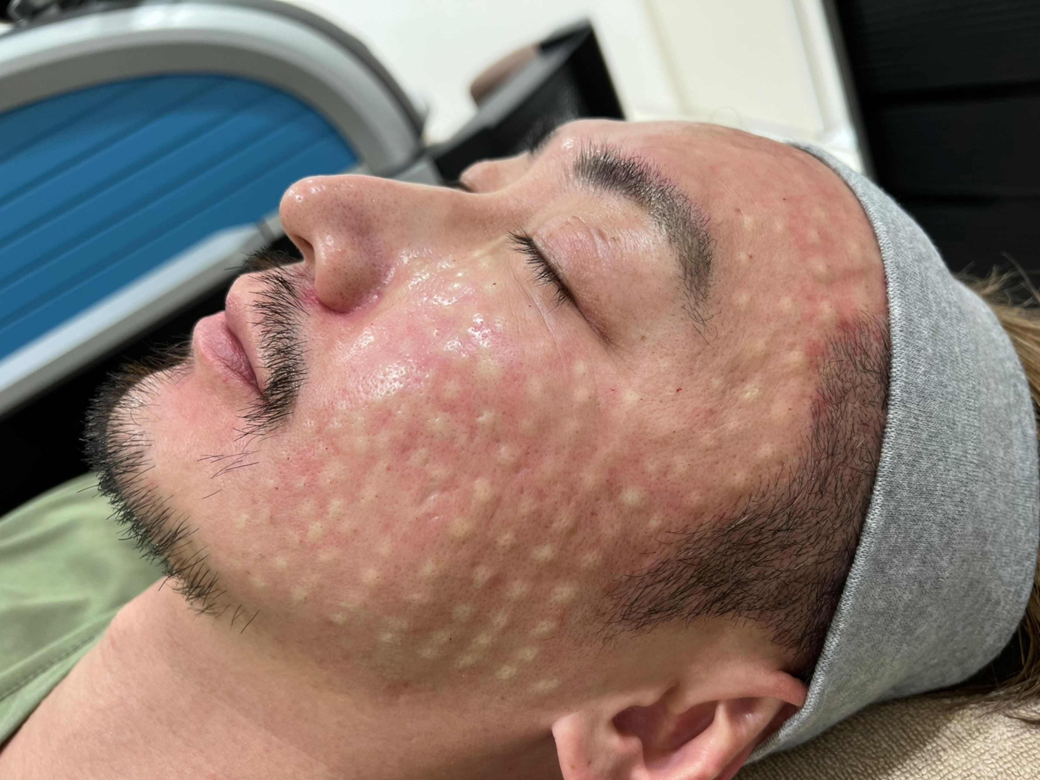 リピート多数！スタッフからも大人気💯ハイドロブースト✨