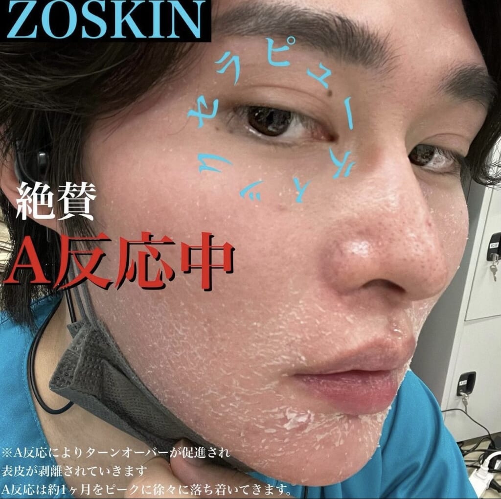 🌸セラピューティック経過🌸開始～2週目編