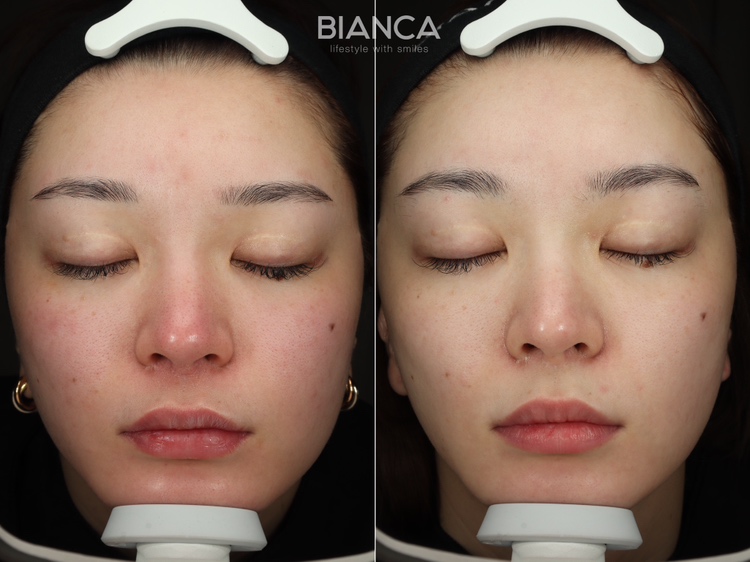 カスタマイズ治療