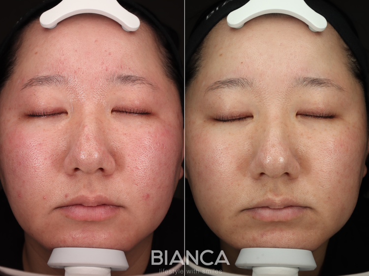 カスタマイズ治療