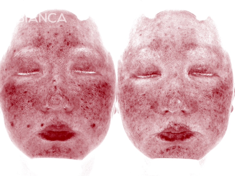 カスタマイズ治療