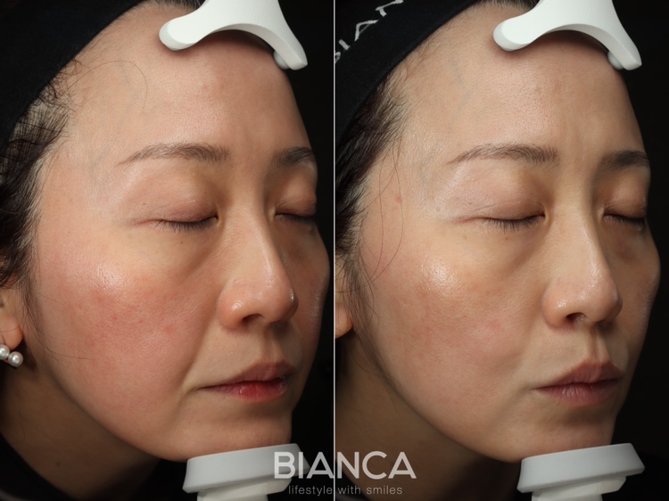 カスタマイズ治療