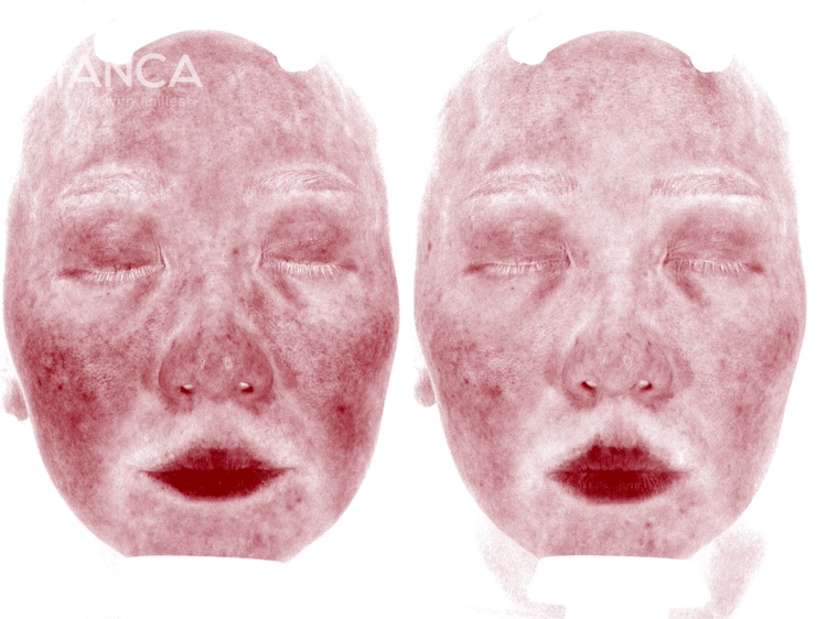 カスタマイズ治療