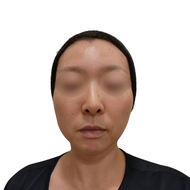 マッサージピール