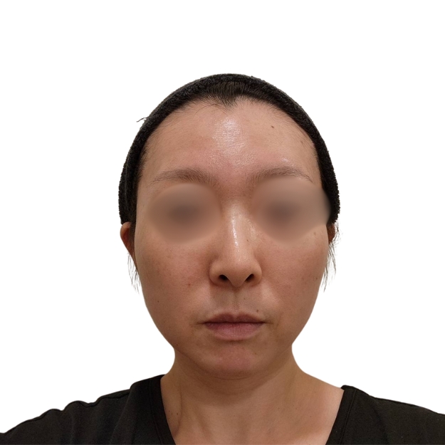 マッサージピール