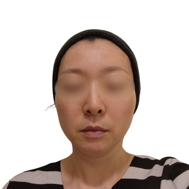 マッサージピール