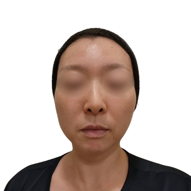 マッサージピール