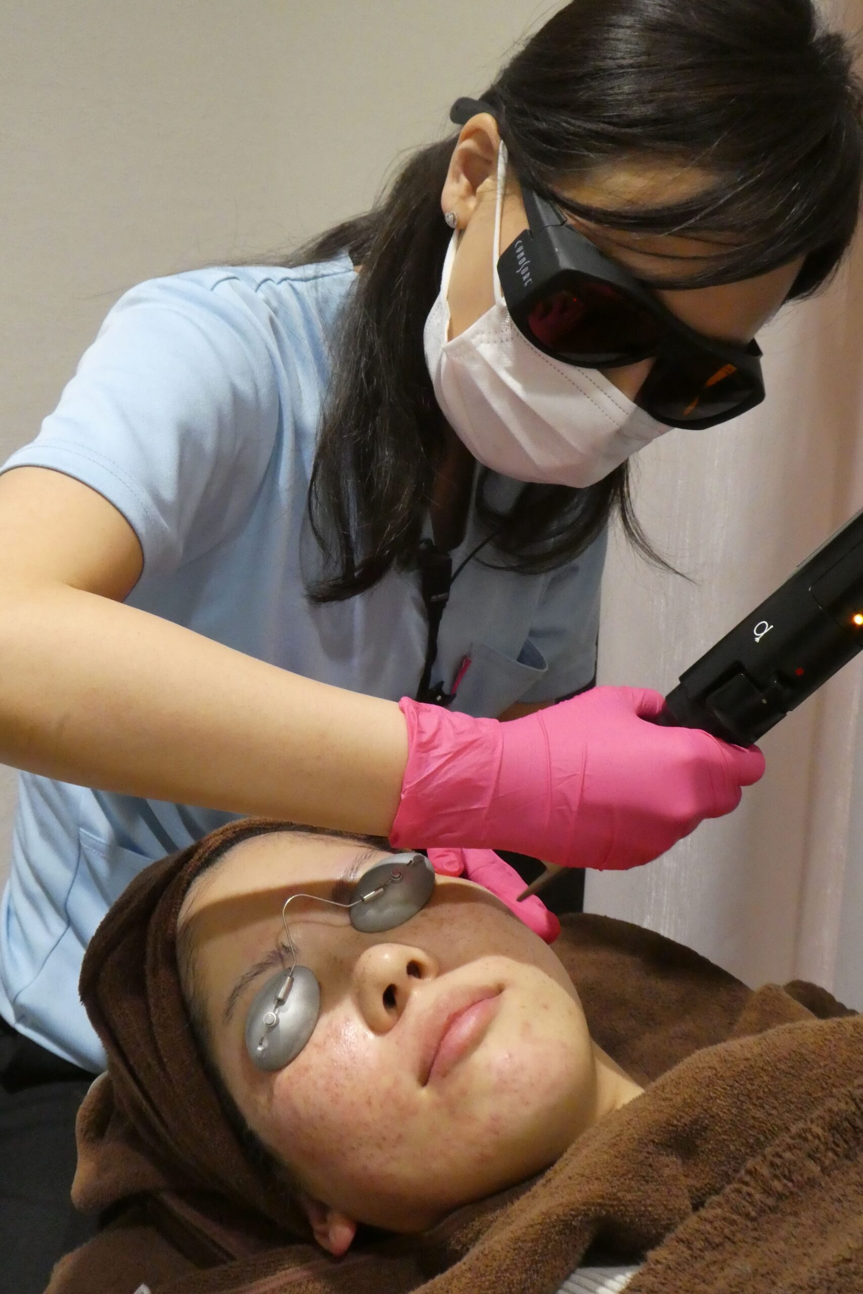 従来のレーザー治療では除去が難しかった肝斑にもアプローチ可能