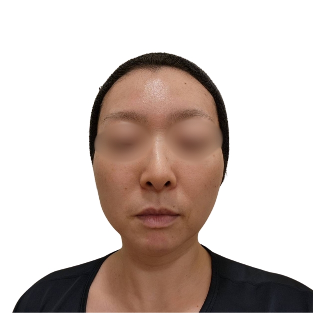 マッサージピール