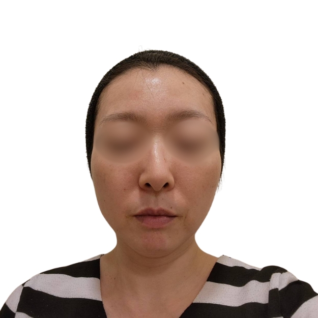 マッサージピール