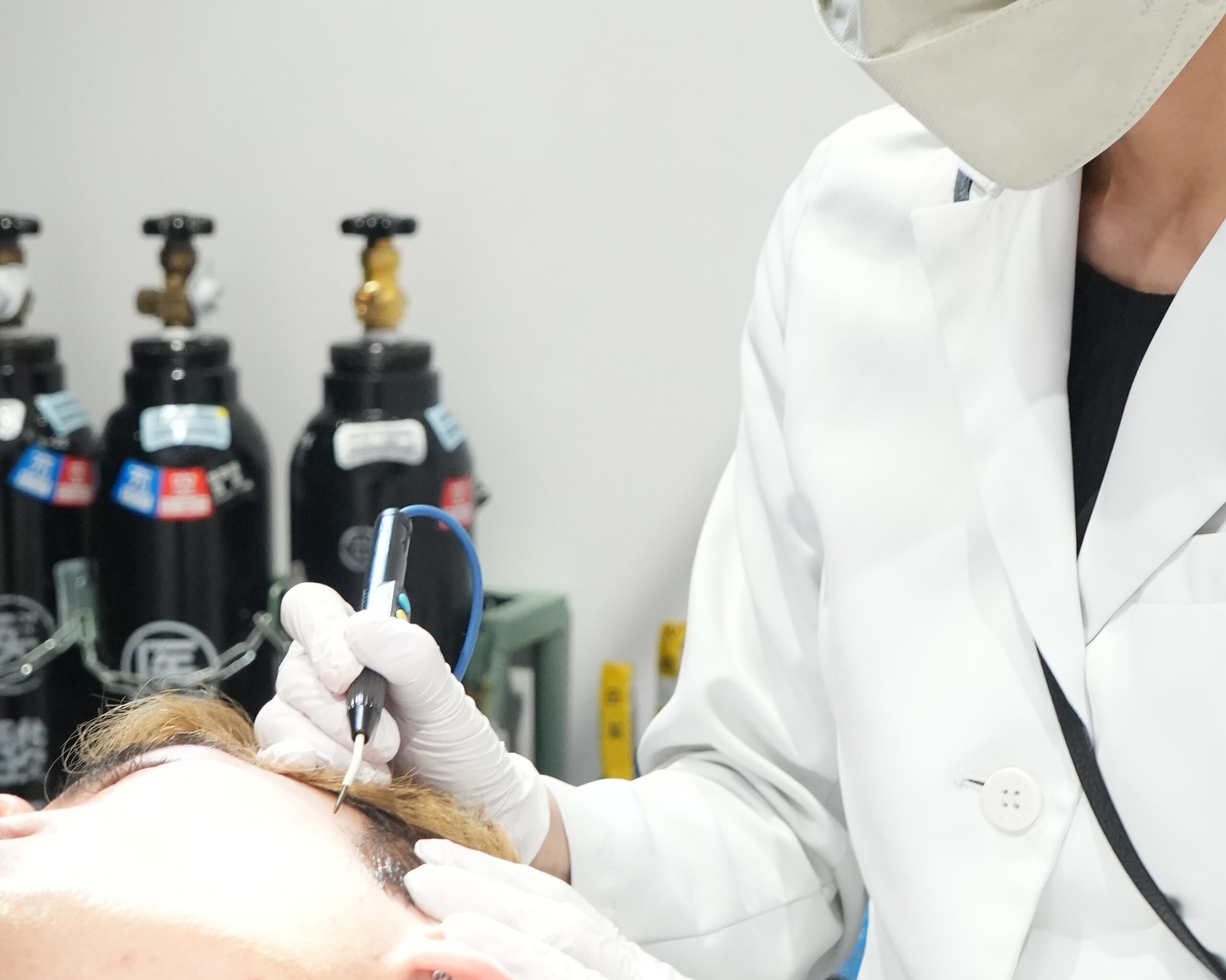 ピンポイント照射で肌へのダメージを抑えた治療