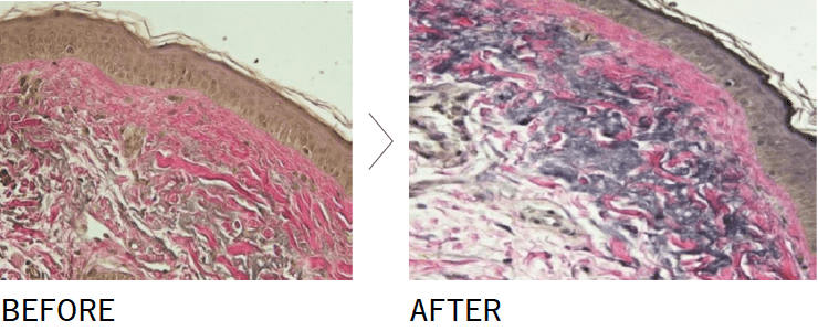 米国サイノシュア社の「ピコシュア」を使用