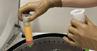 脂肪由来幹細胞（ASC）とは