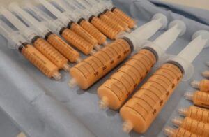 コンデンスリッチ脂肪注入豊胸