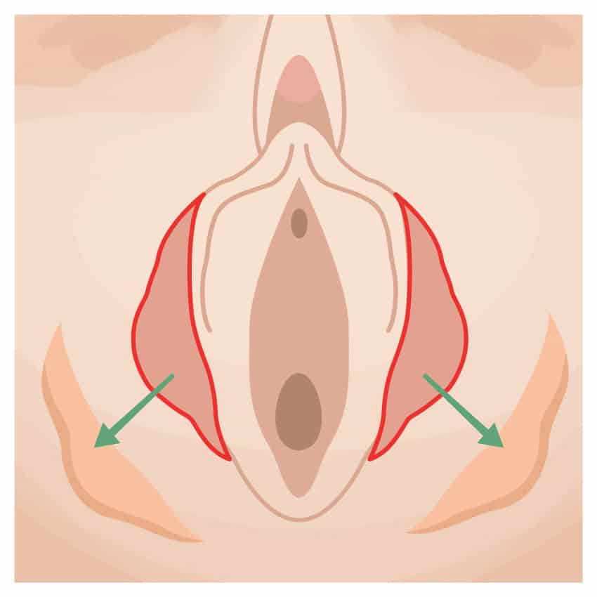 ⼩陰唇縮⼩ ビアンカ銀座｜日本を代表する美容健康再生医療のクリニック