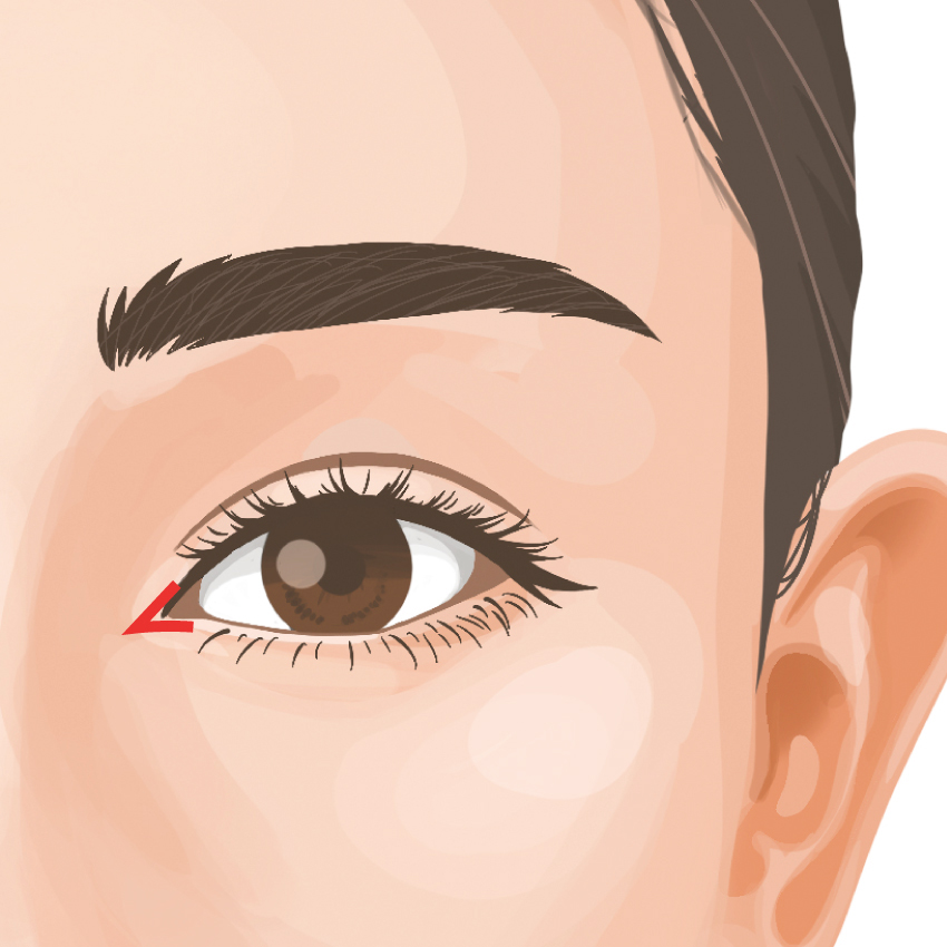 目頭切開 ビアンカ銀座｜日本を代表する美容健康再生医療のクリニック