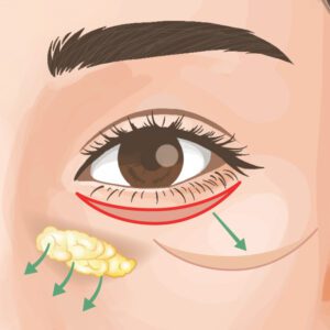 ハムラ法 ビアンカ銀座|日本を代表する美容健康再生医療のクリニック