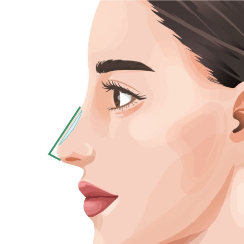 耳介軟骨移植とプロテーゼの違いとは