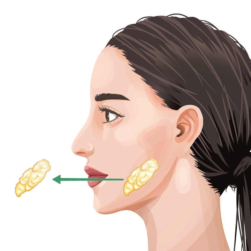 バッカルファット除去 ビアンカ銀座｜日本を代表する美容健康再生医療のクリニック