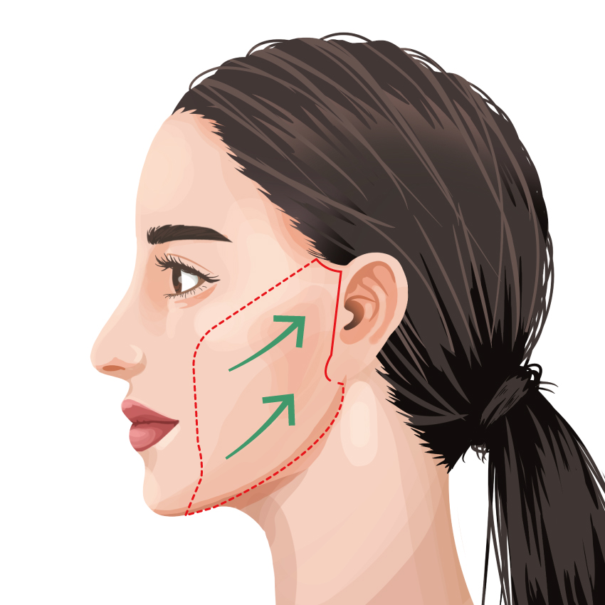 SMASフェイスリフト ビアンカ銀座｜日本を代表する美容健康再生医療のクリニック