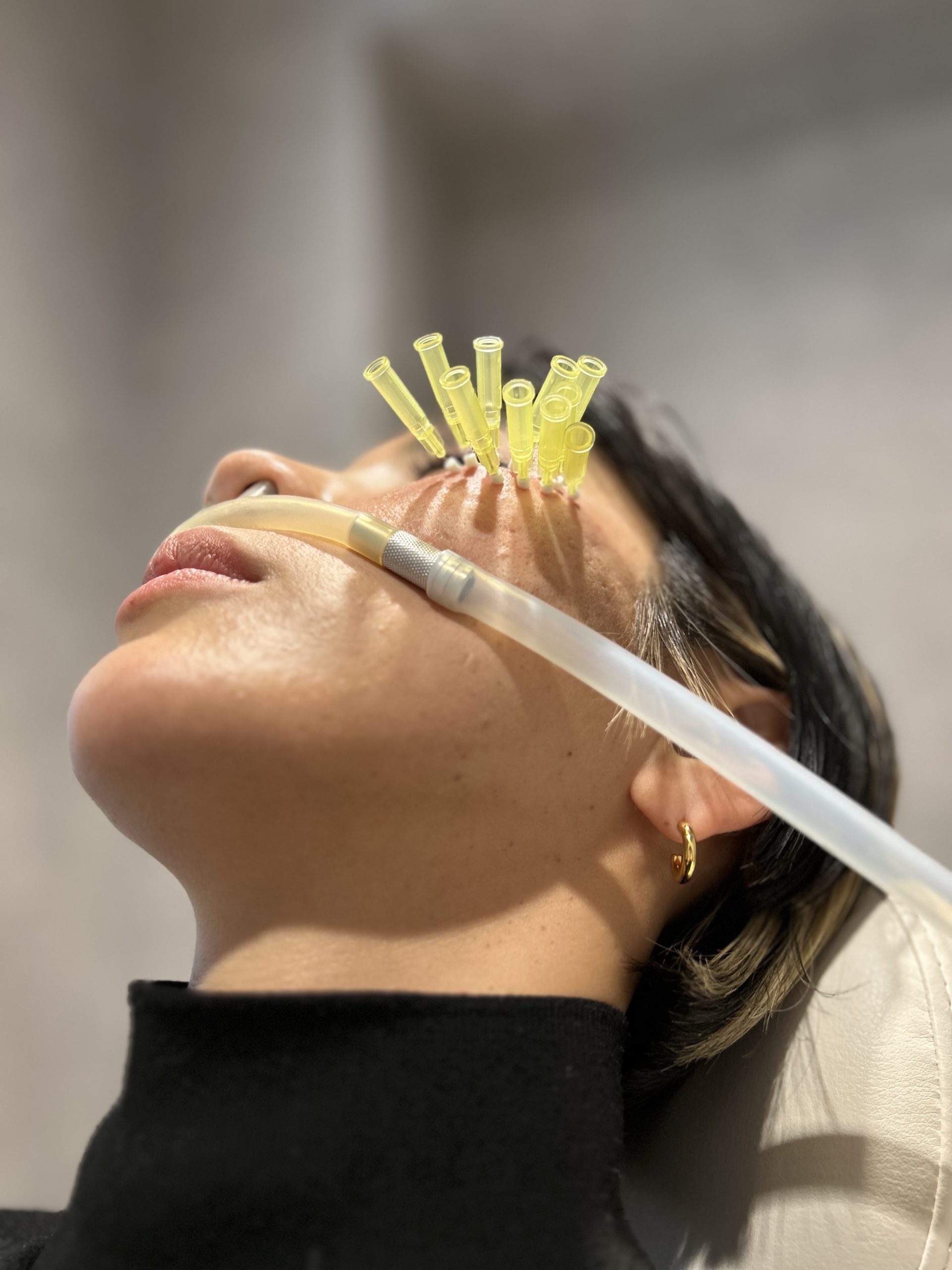 ミニスレッド（ショッピングリフト）ビアンカ銀座｜日本を代表する美容健康再生医療のクリニック