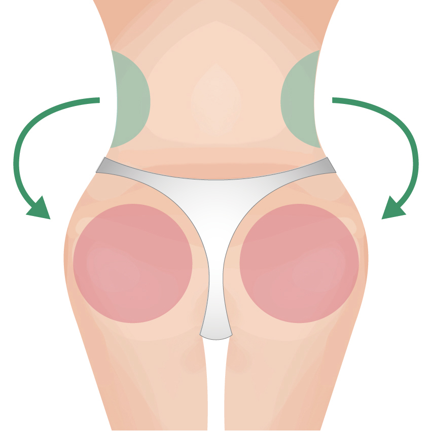豊尻（ブラジリアンバットリフト）